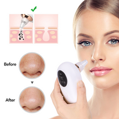Portable Face Deep Pore Cleaner Vacuum Blackhead Remover
